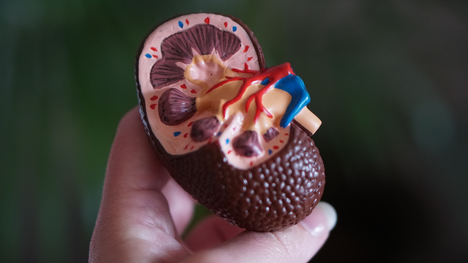 Jak dbać o zdrowie przy kamicy nerkowej? brown kidney decor