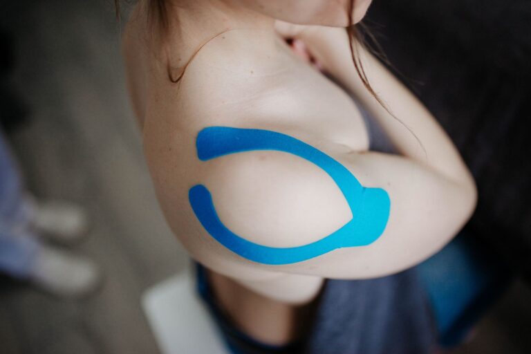 Close-up of a shoulder with kinesiology tape applied for muscle support during sports activities.